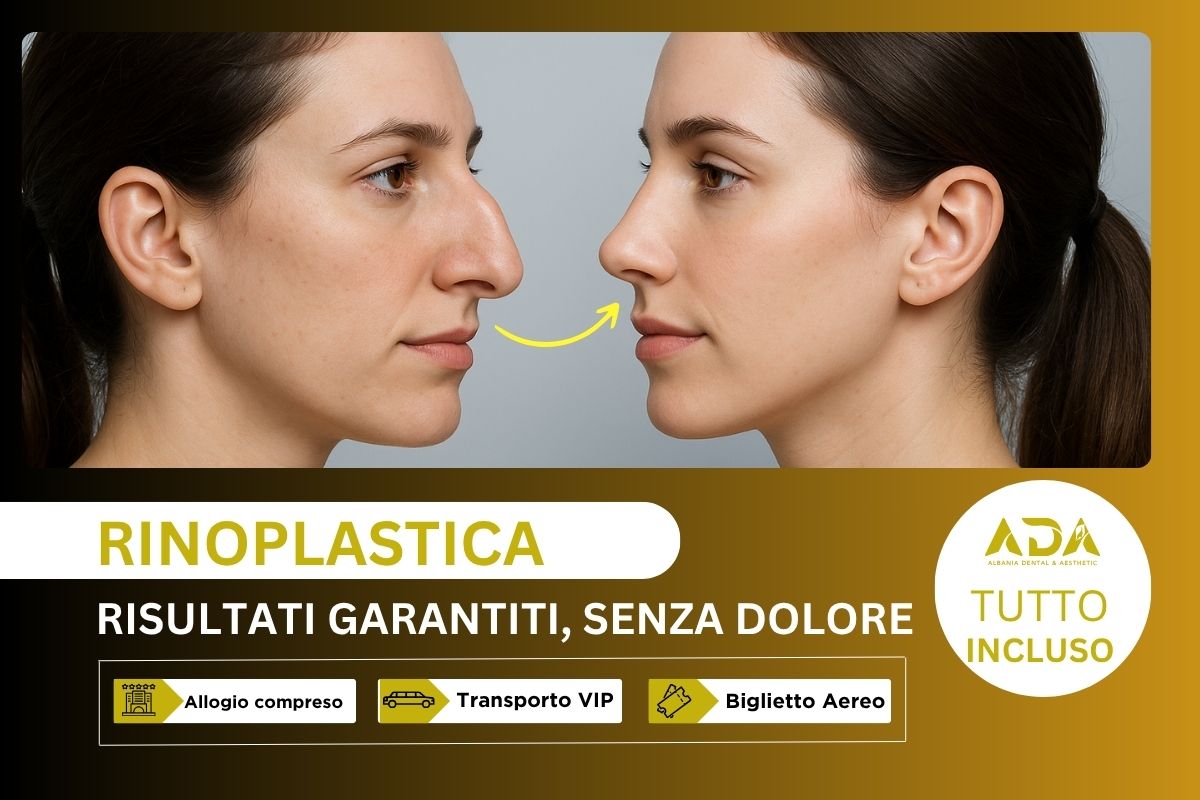 Viaggio Rinoplastica Tirana